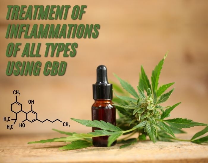 Treatment of inflammations of all types using CBD